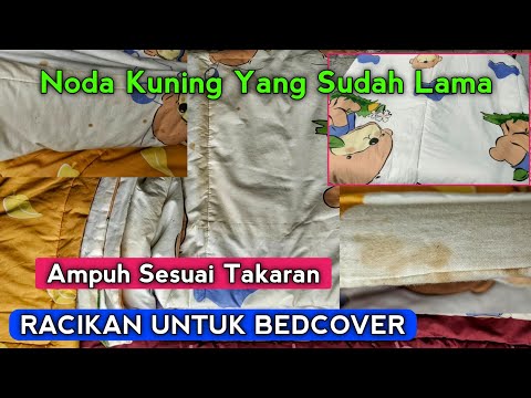 Cara Menghilangkan Noda Kuning Yang Sudah Lama -Racikan Ampuh & Tips