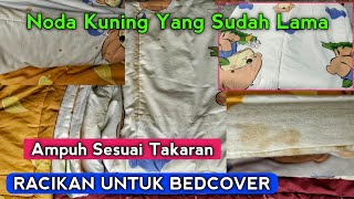 Download Lagu Cara Menghilangkan Noda Kuning Yang Sudah Lama -Racikan Ampuh \u0026 Tips MP3