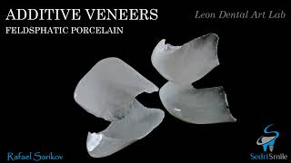 Additive (Partial) Ceramic Veneers