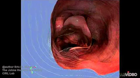 Three-Dimensional Reconstruction of Endoscopic Images