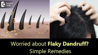 Thick flaky Dandruff  Causes, Prevention \& Treatment - Dr. Rasya Dixit | Doctors' Circle