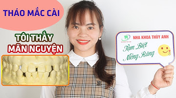 THÁO MẮC CÀI NIỀNG RĂNG THƯA- Tôi thấy mãn nguyện & ưng ý