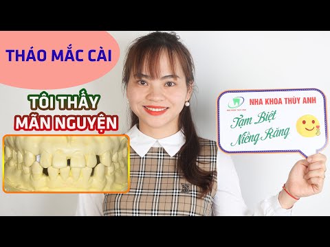 cách vệ sinh răng niềng tại Kemtrinam.vn