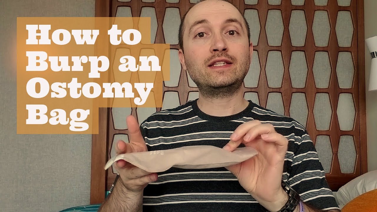 How to Burp an Ostomy Bag (w/ video)