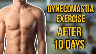 Gynecomastia : Exercise After 10 Days || Dr. Jayanta Bain plastic & cosmetic surgeon