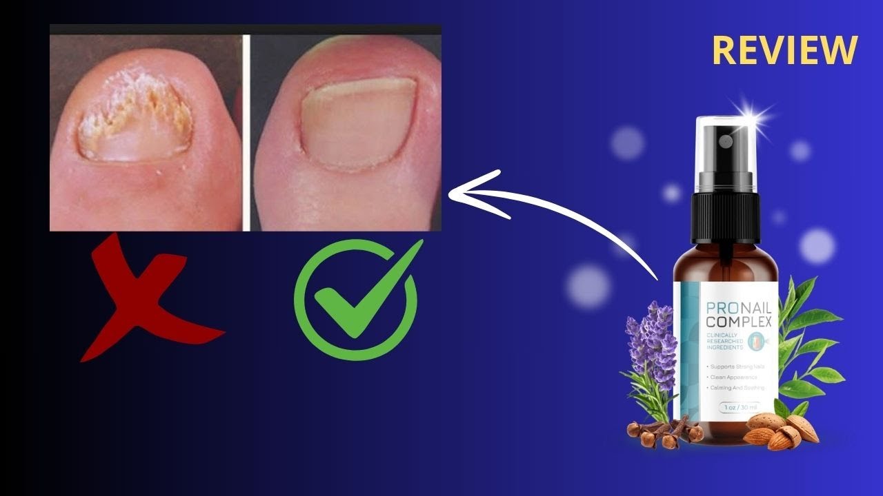 ProNail Complex – ⚠️​ALERT⚠️​ – ProNail Complex official website | Does ProNail Complex Really Work?