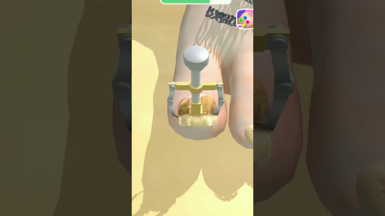 foot treatment 😮💥 