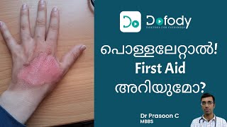 പൊള്ളലേറ്റാൽ Ice, Paste മതിയോ? |  Best Burn Ointment & First Aid of Minor Burns | Malayalam screenshot 5