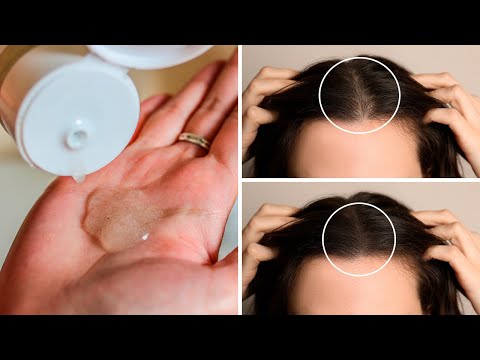 Homemade Comfrey Shampoo to Revitalize and Grow Hair Faster