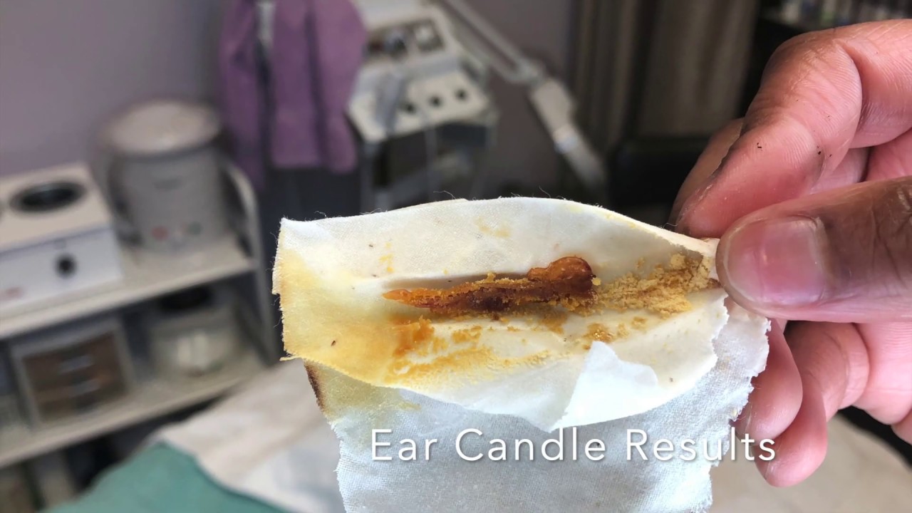 Ear Candling YouTube