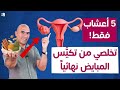 5 أعشاب فعالة لعلاج تكيس المبايض وتنظيم الهرمونات طبيعي ا 5 أعشاب فعالة لعلاج تكيس المبايض وتنظيم الهرمونات طبيعي ا