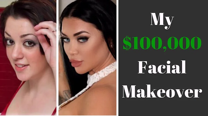 I Got $100,000 In Facial Plastic Surgery