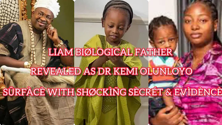 It's ovêr!!! Liam biological father Revèàl o this unbelievable Dr Kemi Olunloyo sūrfàcè wit evìdèncè
