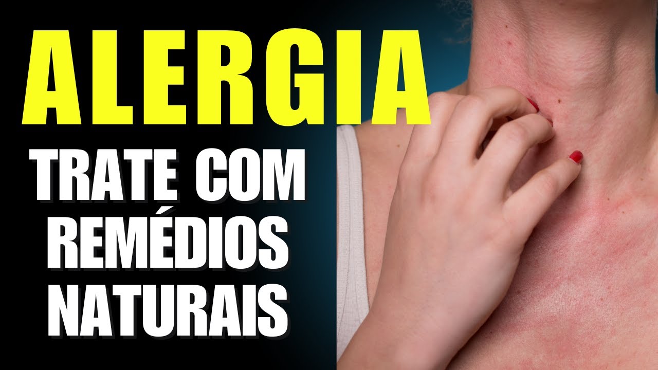COMO ACABAR COM AS ALERGIAS E IRRITAÇÕES NA PELE - YouTube