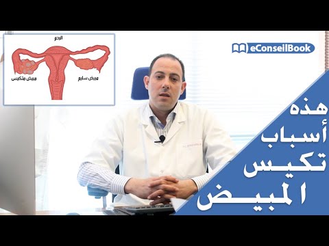    ما هي علامات مشكل تكيس المبيض وسبل علاجه الدكتور المهدي حسان