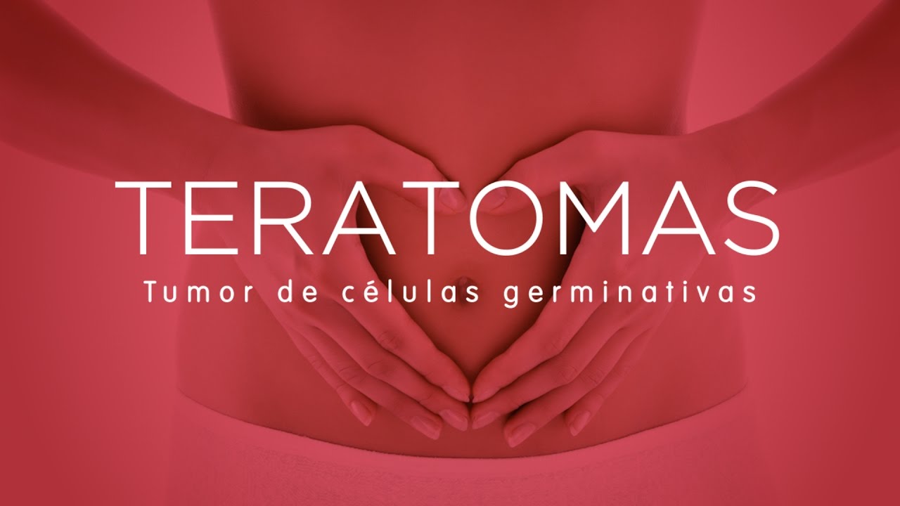 Porno caiu na net funk carioca Amiga chupando a buceta cheia de porra