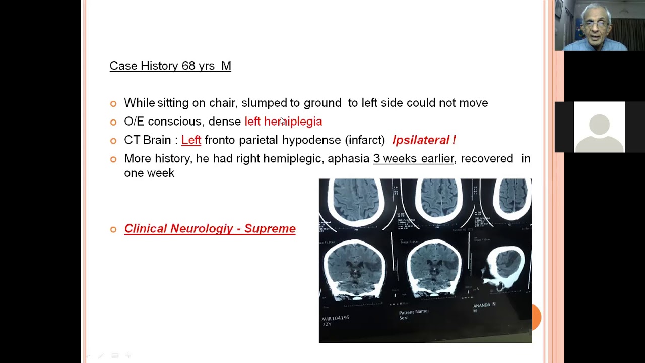 Clinical localisation of Stroke-Dr HV srinivas - YouTube