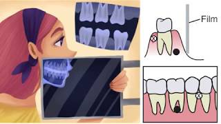 CT and CBCT basic understanding شرح مبسط لأشعة الأسنان ثلاثية الأبعاد - أشعة الفم والوجه والفكين