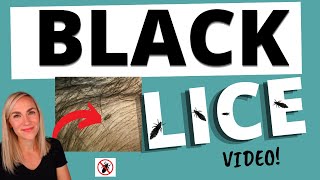Black Head Lice