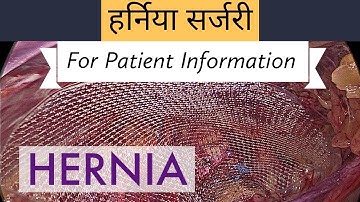 LAPAROSCOPIC INGUINAL HERNIA OPERATION - FOR PATIENT INFORMATION IN HINDI