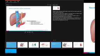 Essentials in Liver Transplant: Vascular and Biliary Complications