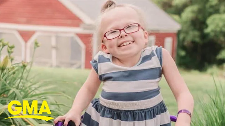 9-year-old born with rare form of dwarfism uplifts...