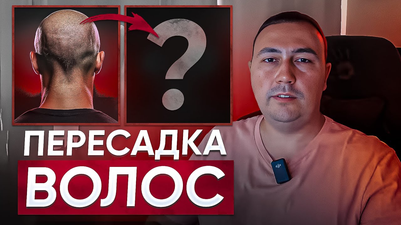 Как Убрать Лысину? Все о ПЕРЕСАДКЕ ВОЛОС в Московской Клинике R.T.H ...