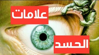 هل تعرف علامات وأعراض الحسد؟ وماهو أفضل علاج للمحسود؟