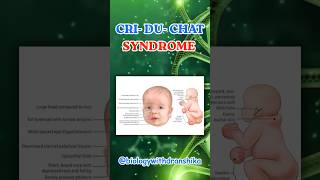 Cri du Chat Syndrome – A rare genetic disorder caused by deletion on chromosome 5 #CriDuChat Cri du Chat Syndrome – A rare genetic disorder caused by deletion on chromosome 5 #CriDuChat