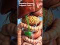 The liver, gallbladder, and pancreas play a major role in the digestion #anatomy #facts #woodanatom