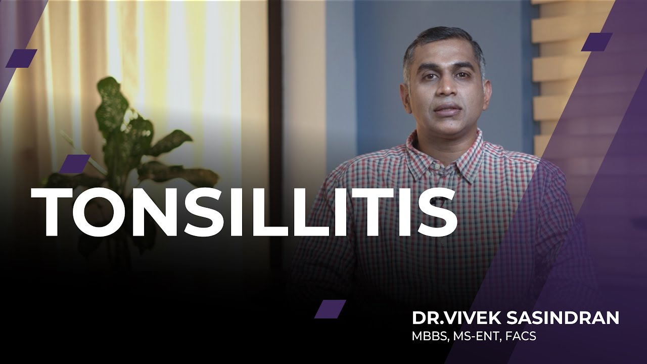 Acute and Chronic Tonsillitis, Causes, Signs and Symptoms, Diagnosis and Treatment | English