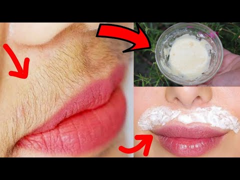 ঠোঁটের উপরের চুল upper lips hair ১বার দূর করার পর সারা জীবনেও আসবে না। Facial hair treatment