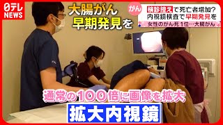 【大腸がん】年間５万人が死亡  早期発見と予防のポイントは？  『every.特集』