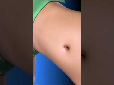 فديو توضيحي ل عملية استئصال المراره 