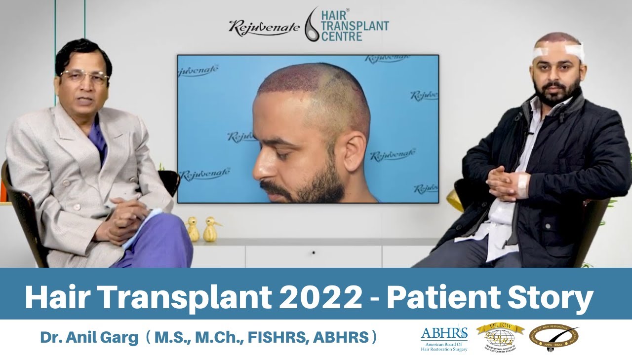 Hair Transplant Surgery | Hair Transplant in Delhi, Indore, Bhopal | Hair  Transplant in India - YouTube