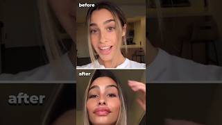 Crazy Face Transformation | Plastic Surgeon Reacts