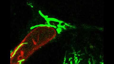 Newly discovered cytoskeleton helps cancer cells survive