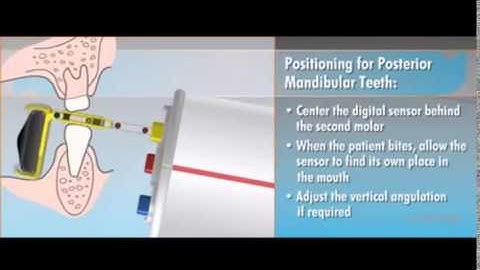 QuickRay Plus DentsPly Rinn Positioners