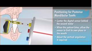 QuickRay Plus DentsPly Rinn Positioners
