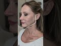 Balanced Jawline Results 🔥👀