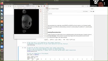 BART Webinar #1 Day 1 Part 3: GRASP-like MRI reconstruction