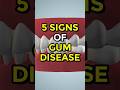 5 Signs Of Gum Disease Gumdisease Ytshorts
