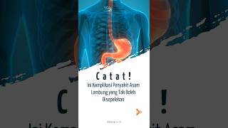 Catat Ini Komplikasi Penyakit Asam Lambung Yang Tak Boleh Disepelekan