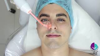 LIMPIEZA FACIAL HOMBRE Bucaramanga - Tratamiento facial paso a paso 