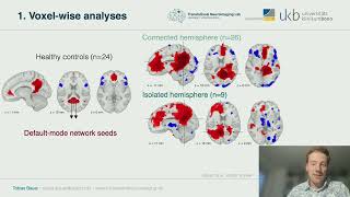 OHBM 2025 | Symposium | Tobias Bauer | Brain network organisation in the isolated hemisphere of pe…