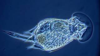 Squatinella rostrum, a rotifer