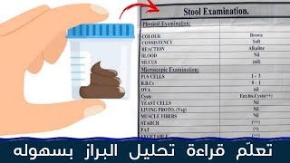 تعلم قراءة تحليل البراز بسهوله | stool analysis