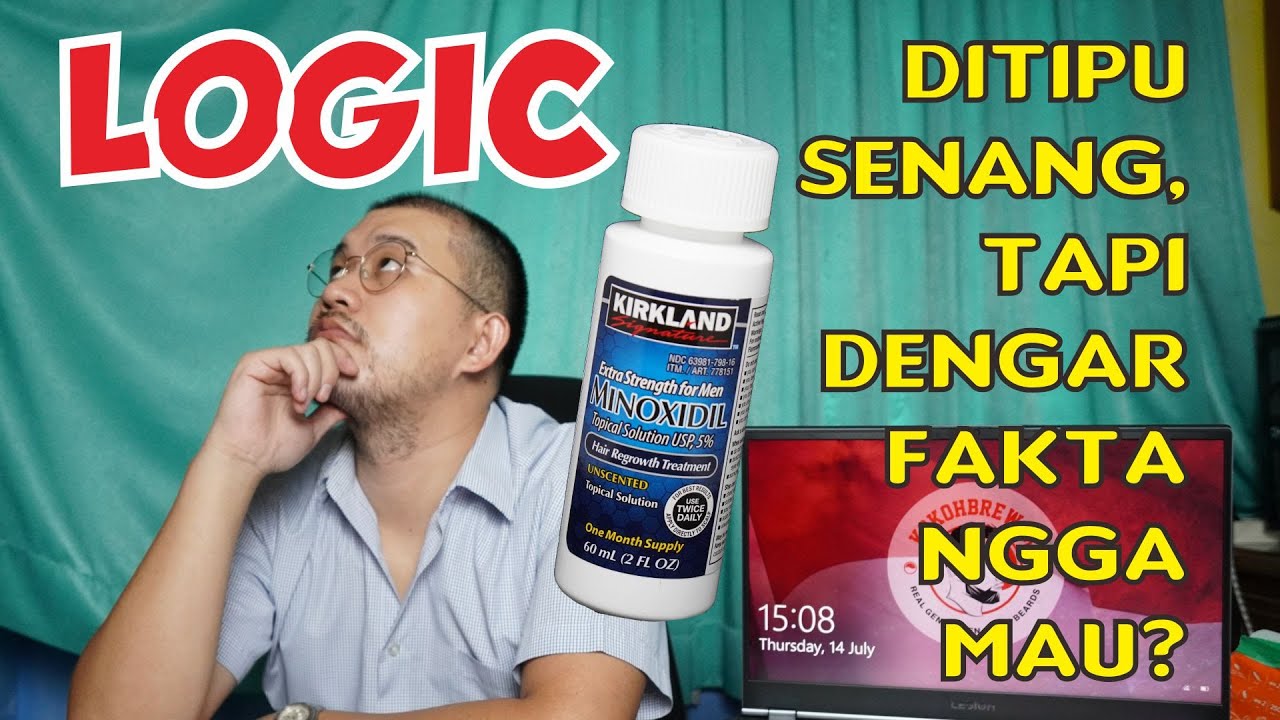 LOGIC ONLY!! MINOX WORTH IT NGGA KOK KOKOHBREWOK TRANSPLANT? SUDAH HAIR TRASNPLANT TETAP PERAWATAN?