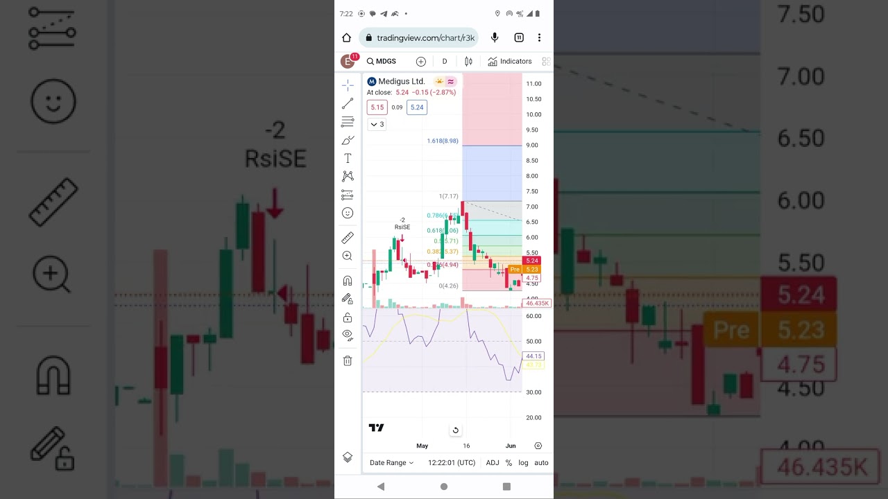mdgs stocks technical analysis