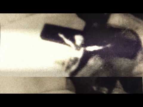 Mildreda — Mildreda - Aborted